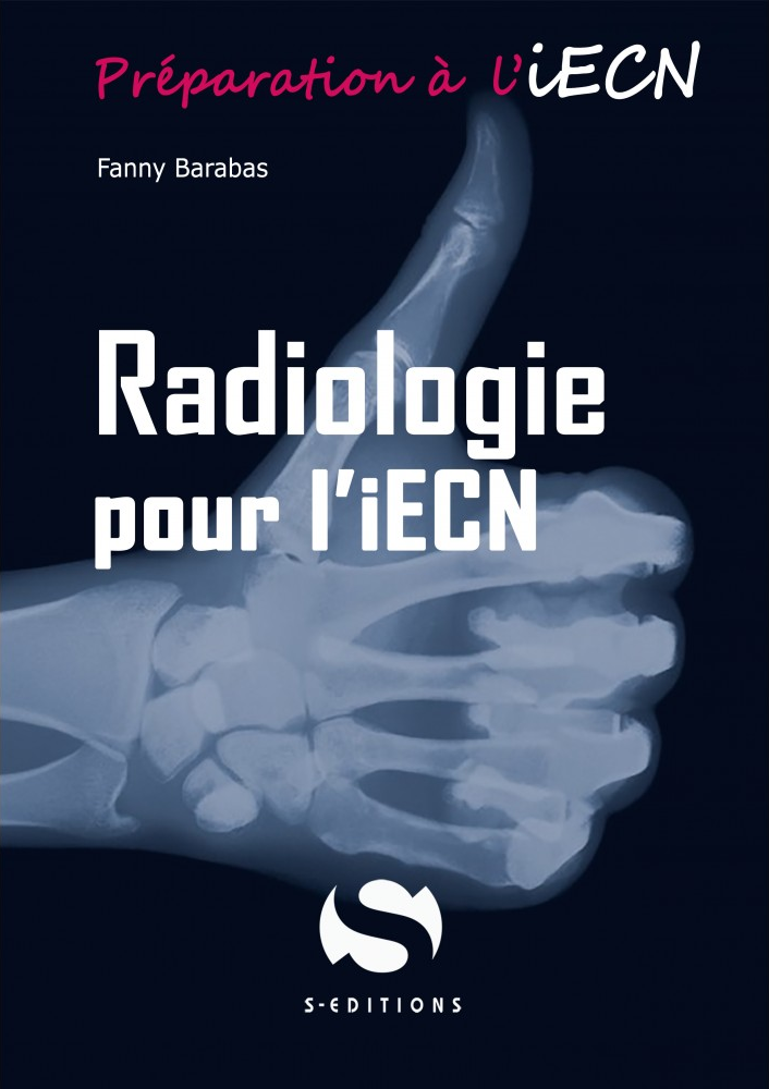 Radiologie pour l'iecn  S EDITIONS  Préparation à l'iECN  9782356401854